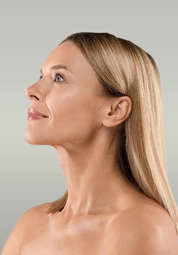 شد الوجه غير الجراحي